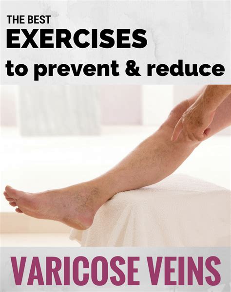 venous leak exercise|The 7 Best Exercises To Reduce Varicose Vein。